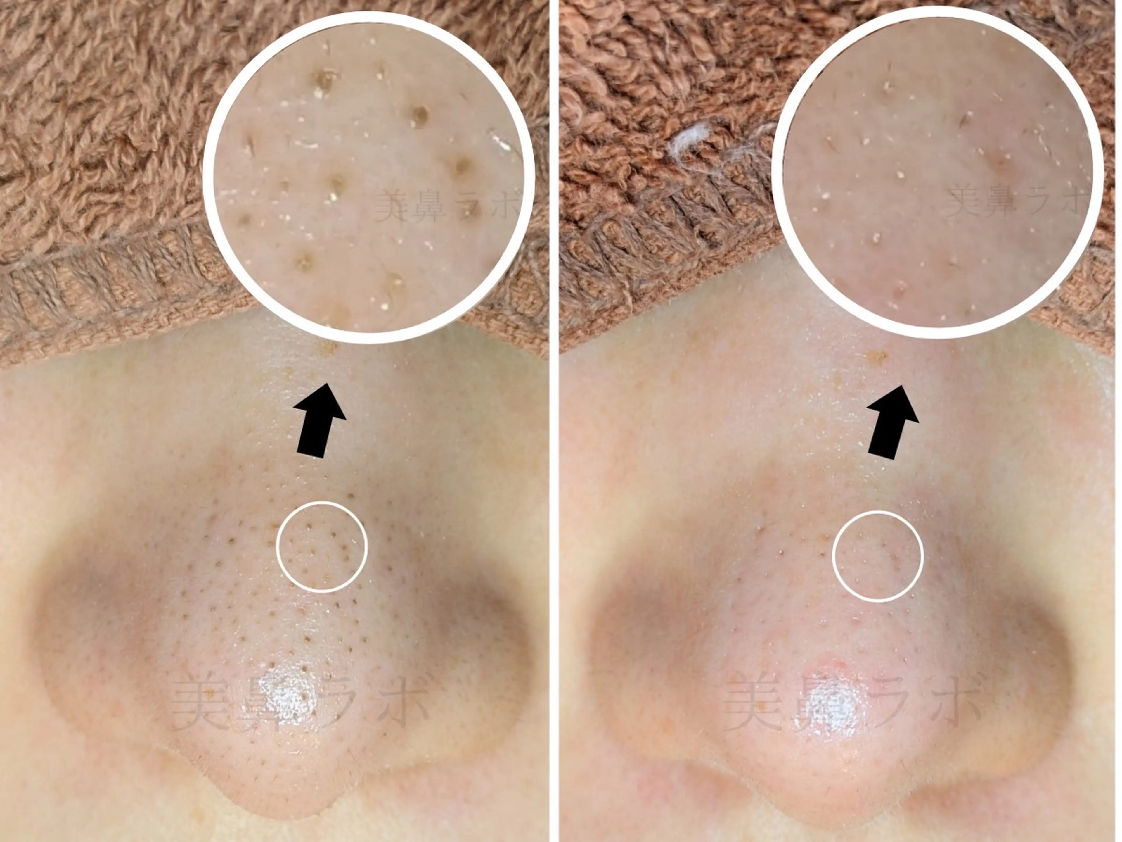 毛穴ケア専門店 美鼻ラボ