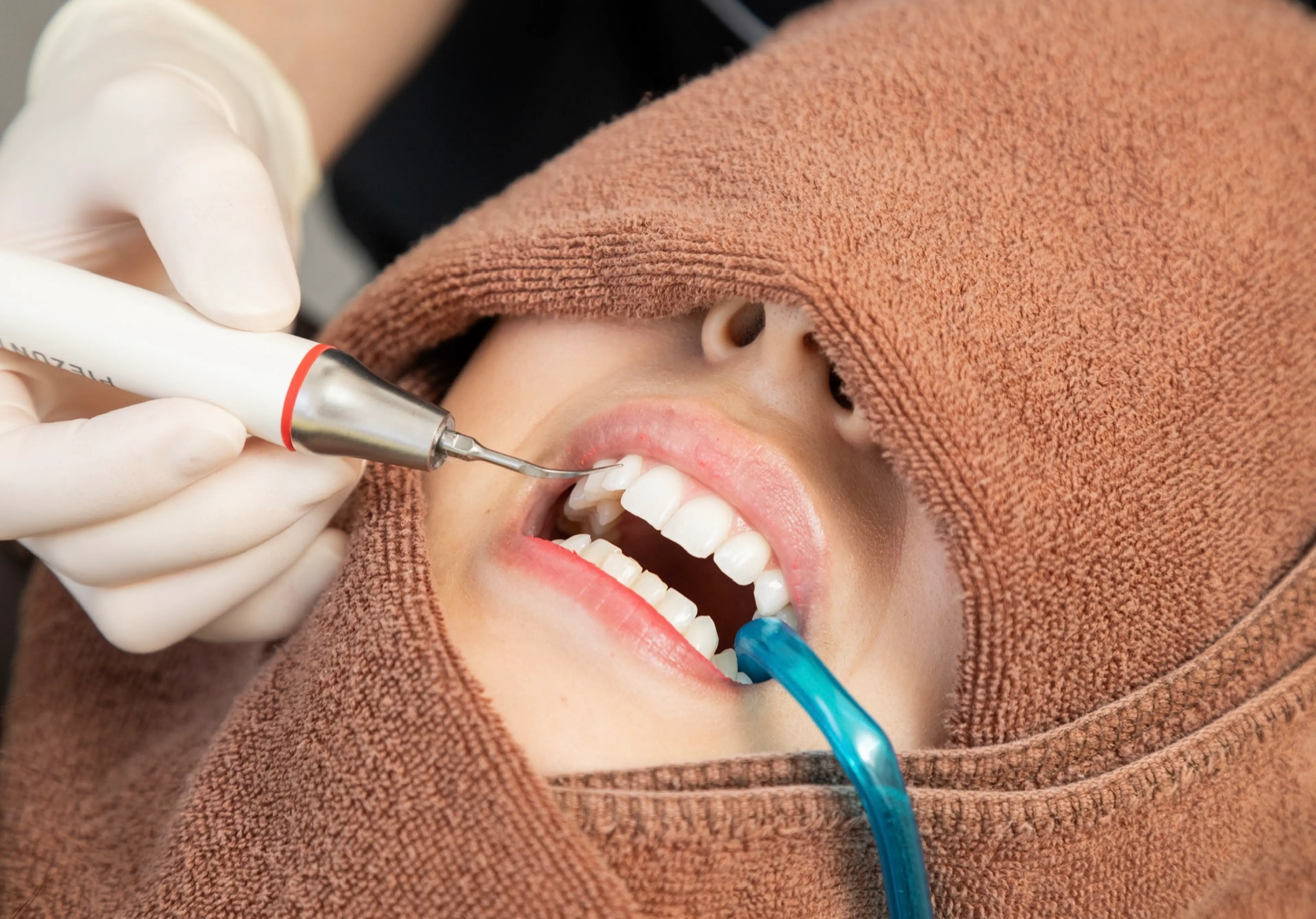 Whitening Salon Beaute Shinsaibashi Dental Clinic