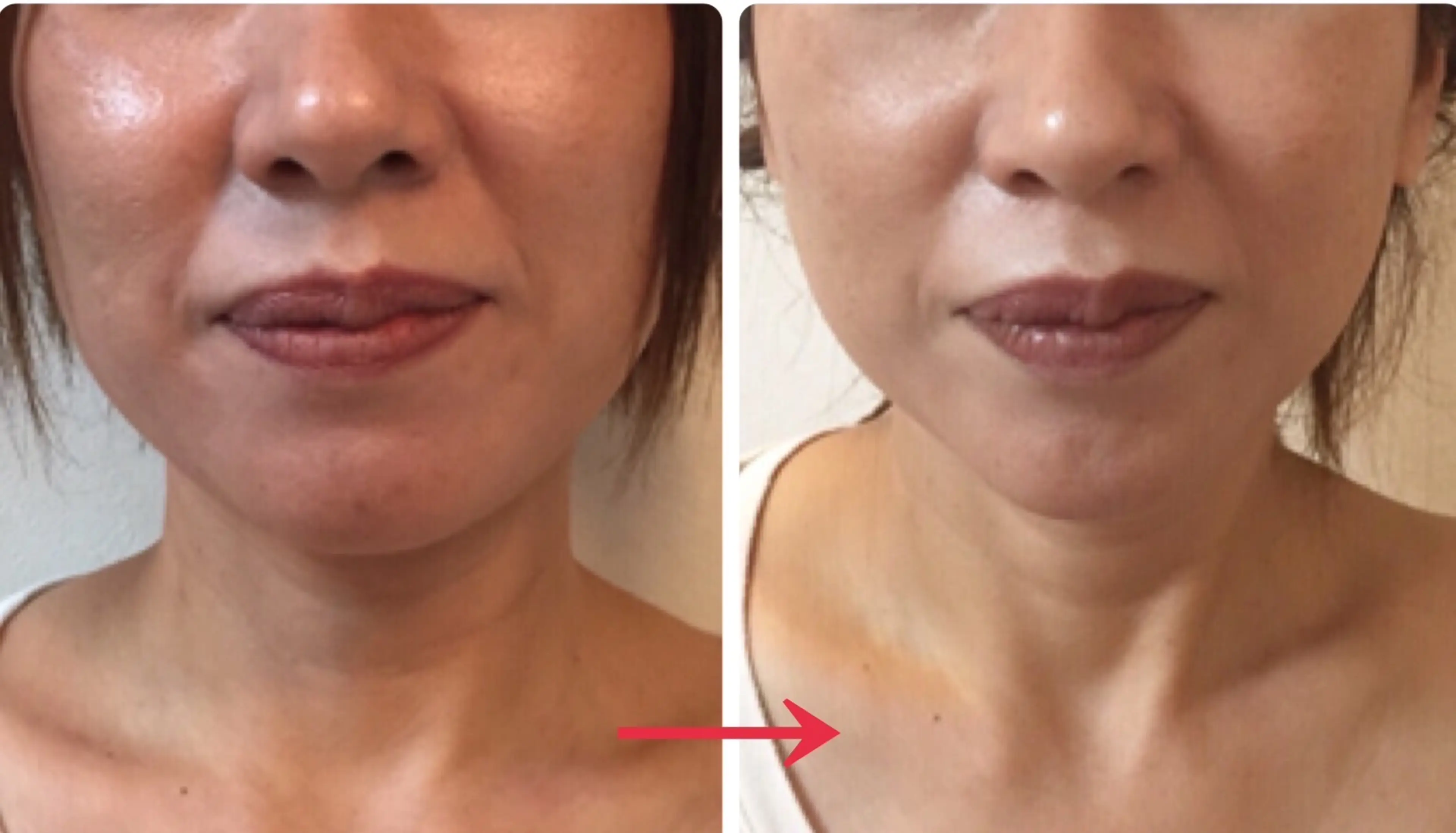 Skin beauty salon REVISHOP (Luvi) Osaka Shinsaibashi