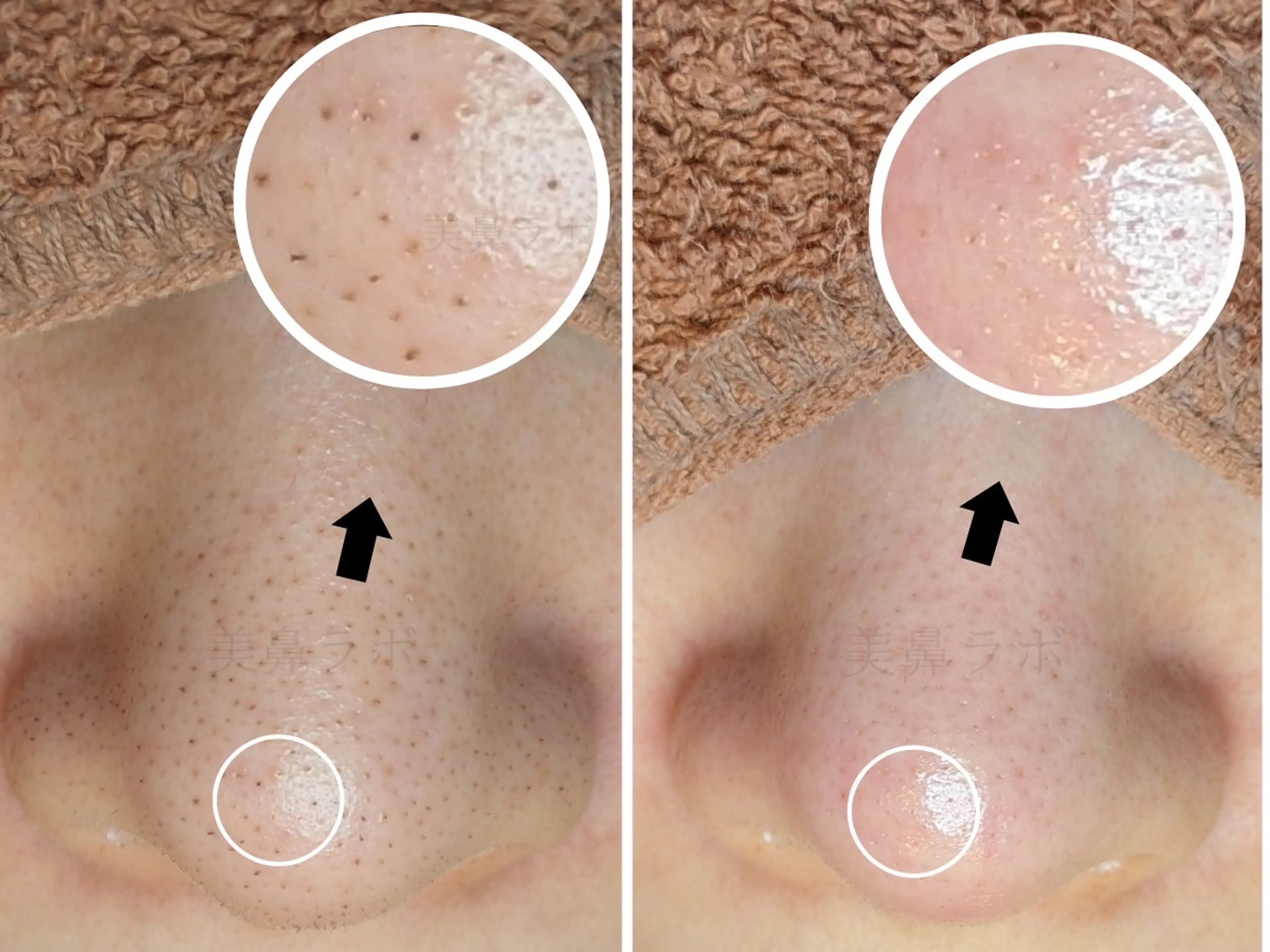 毛穴ケア専門店 美鼻ラボ