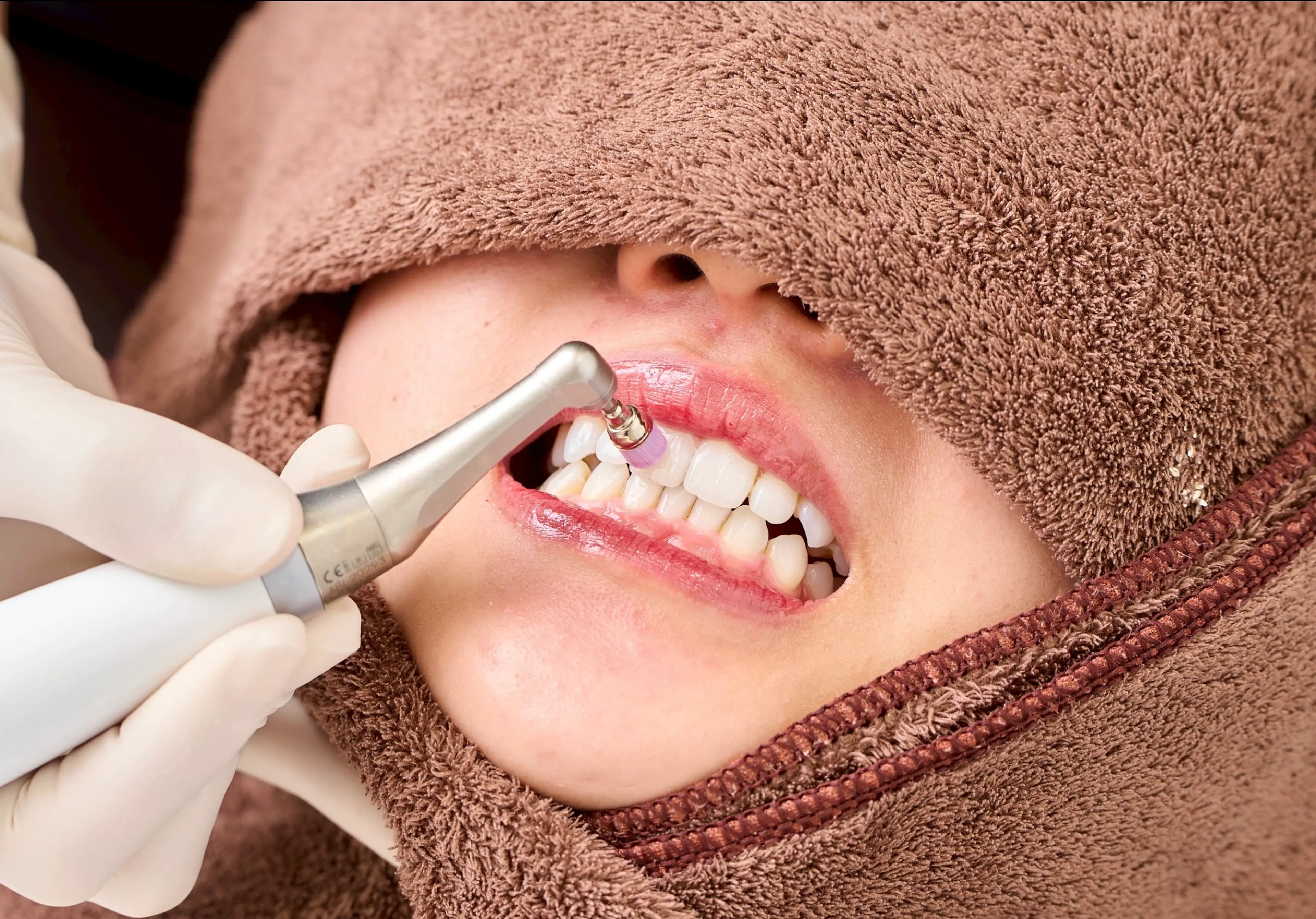 Whitening Salon Beaute Shinsaibashi Dental Clinic