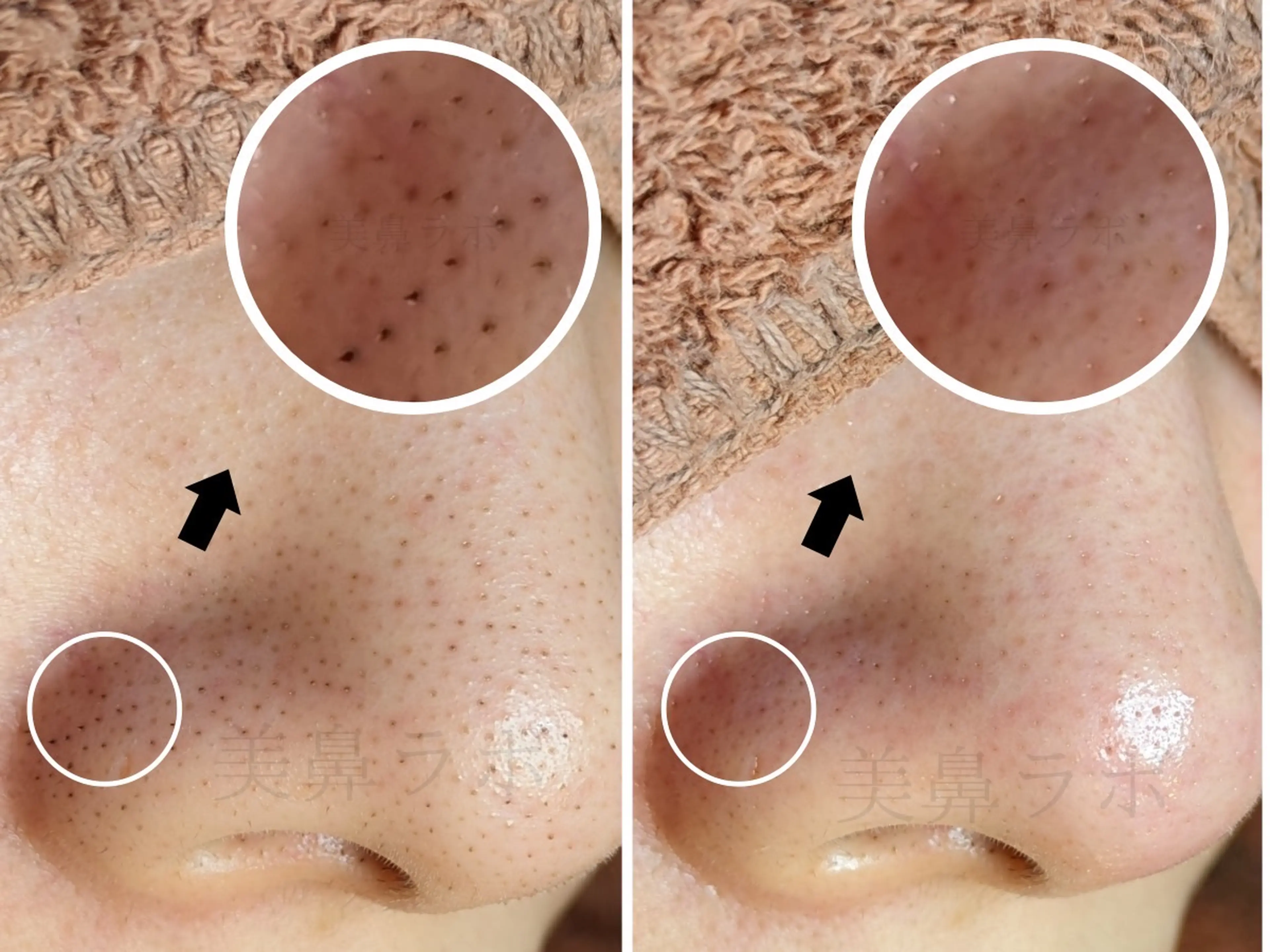 毛穴ケア専門店 美鼻ラボ